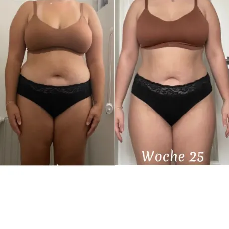 Vorher-Nachher-Transformation von Angelina