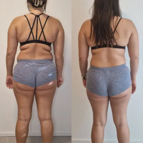 Vorher-Nachher-Transformation von Dzenisa