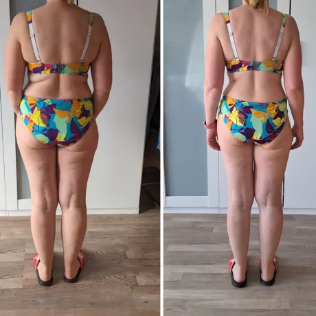 Vorher-Nachher-Transformation von Julia