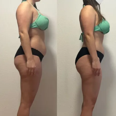 Vorher-Nachher-Transformation von Sofia